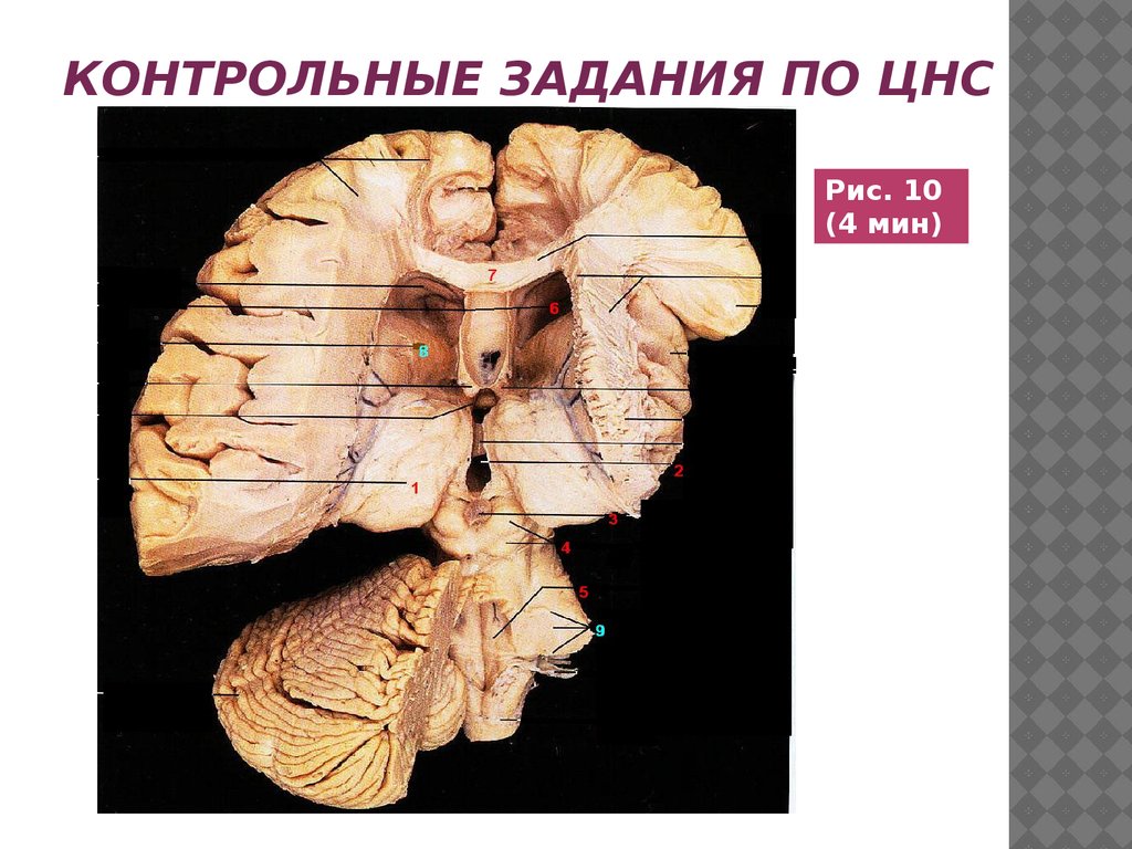 Контрольные задания по цнс