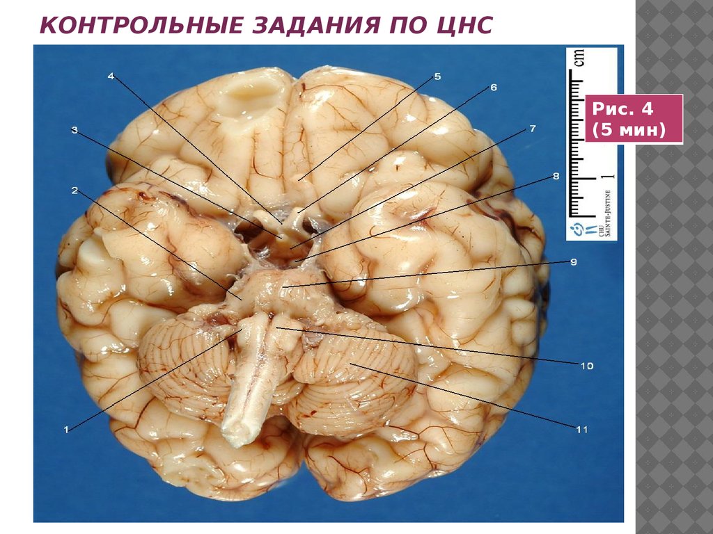 Контрольные задания по цнс