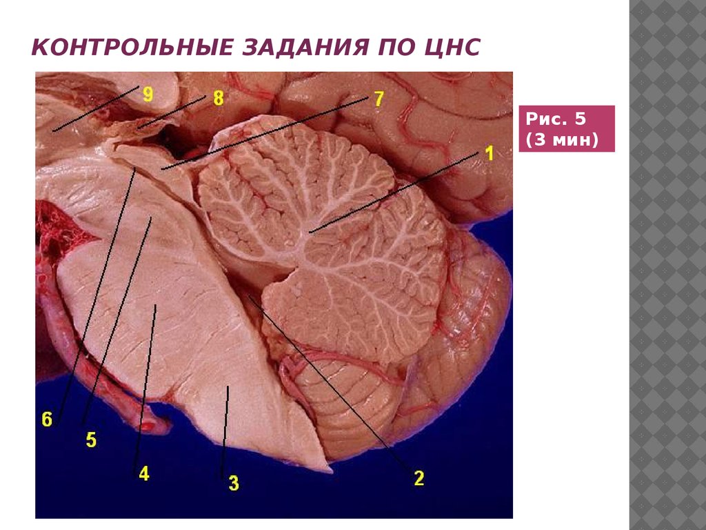 Контрольные задания по цнс