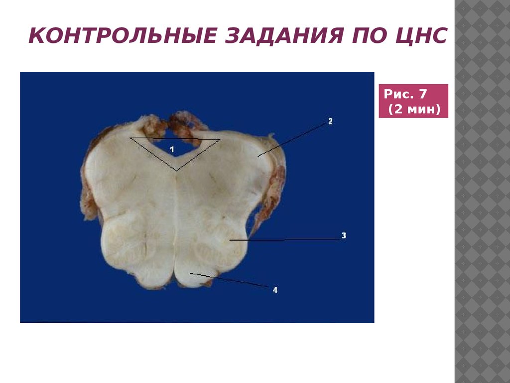 Контрольные задания по цнс