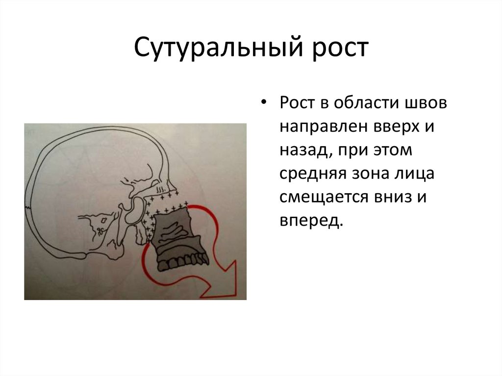 Основы клинической гнатологии биомеханика зубочелюстно лицевой системы презентация