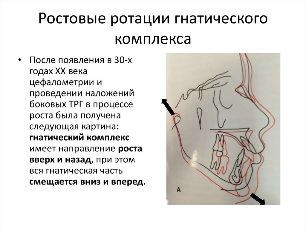 Основы клинической гнатологии биомеханика зубочелюстно лицевой системы презентация