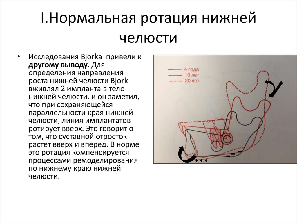 Основы клинической гнатологии биомеханика зубочелюстно лицевой системы презентация