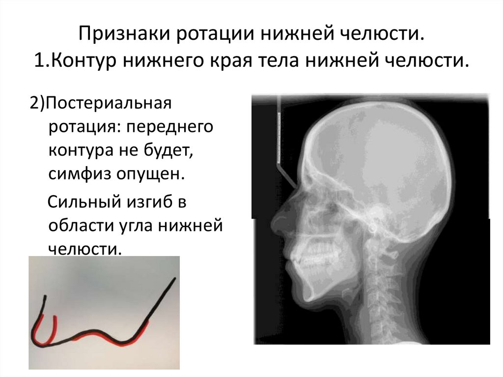 Основы клинической гнатологии биомеханика зубочелюстно лицевой системы презентация