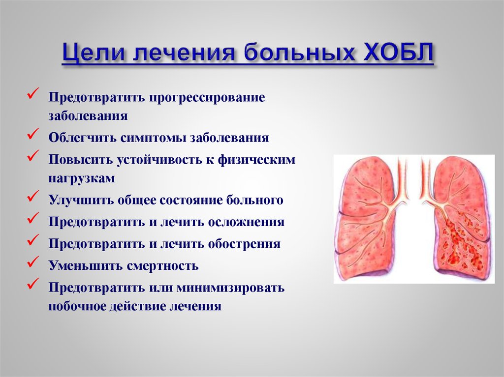 Хобл картинки для презентации