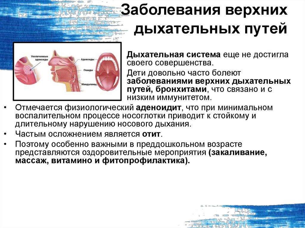 Вирусная инфекция верхних дыхательных путей. Инфекции верхних дыхательных путей этиология. Заболевания верхних дыхательных путей: клинические проявления. К заболеваниям верхних дыхательных путей относят. Забрлевнтч верхних двхатнльных пцтеы.