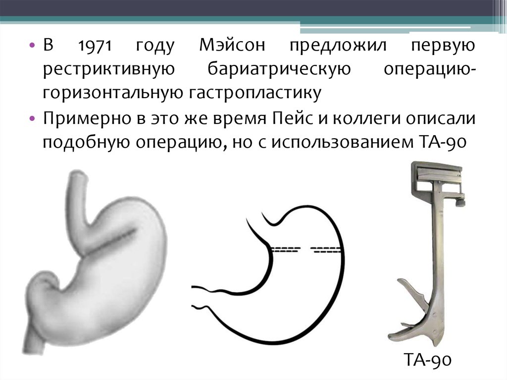 Суть бариатрической операции