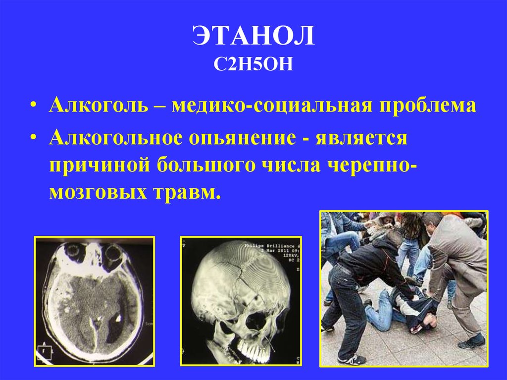 ЭТАНОЛ С2Н5ОН