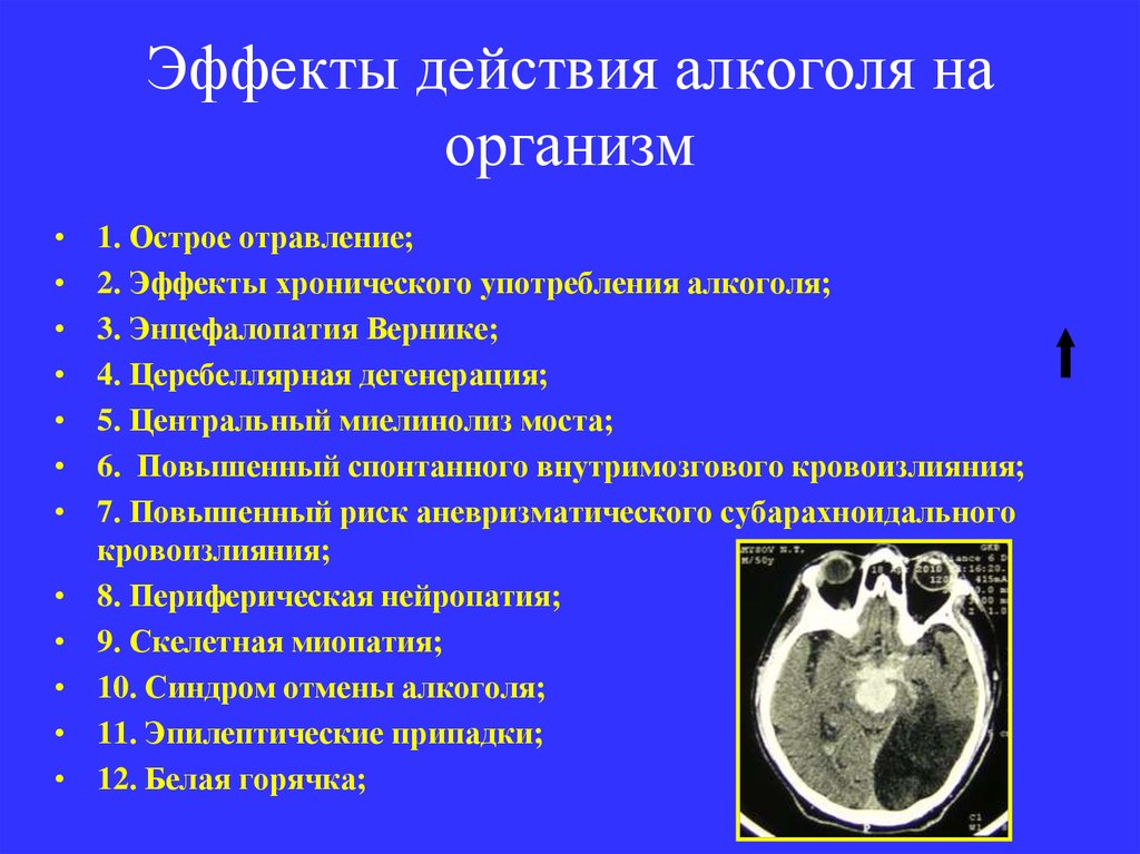 Эффекты действия алкоголя на организм