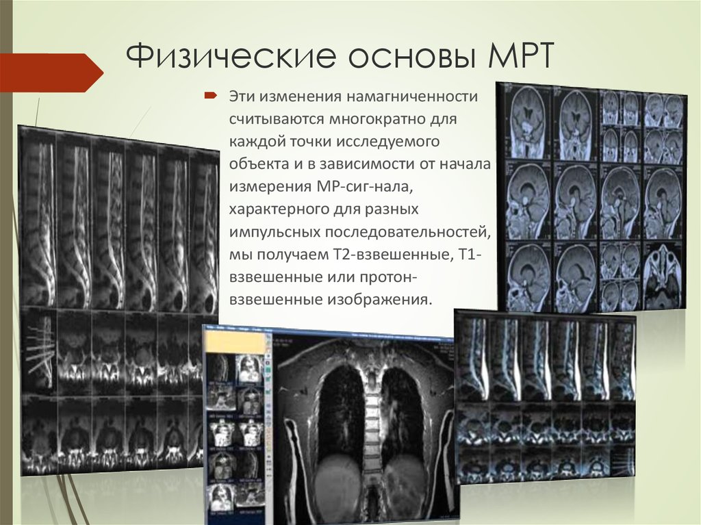 Физические основы мрт презентация