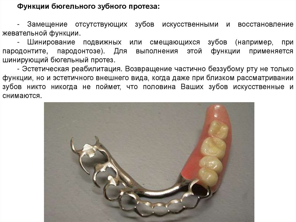 Бюгельные протезы презентация