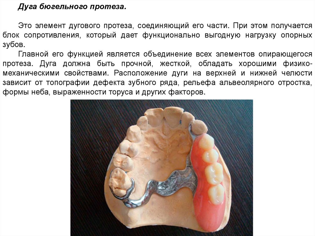 Дуг нужно. Бюгельные протезы презентация. Дуговые бюгельные протезы презентация.