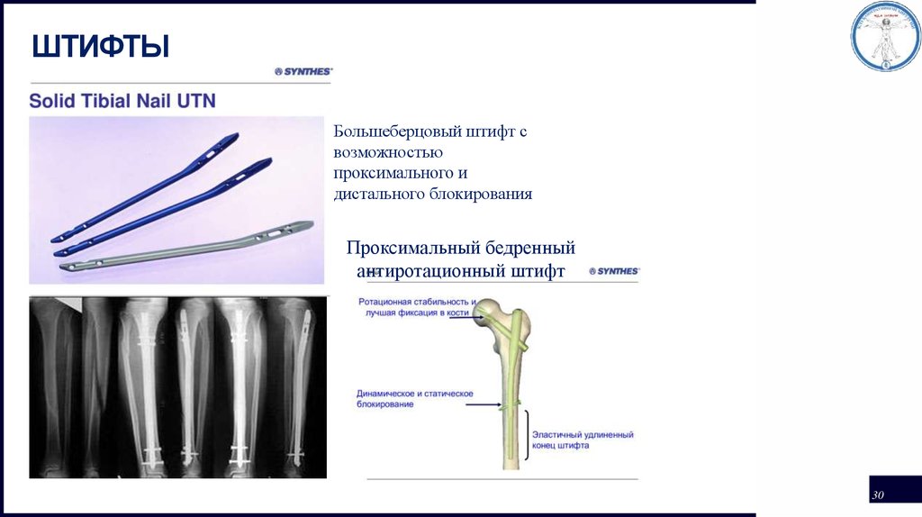 Штифт в травматологии фото