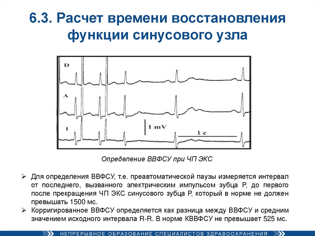 Сссу в кардиологии