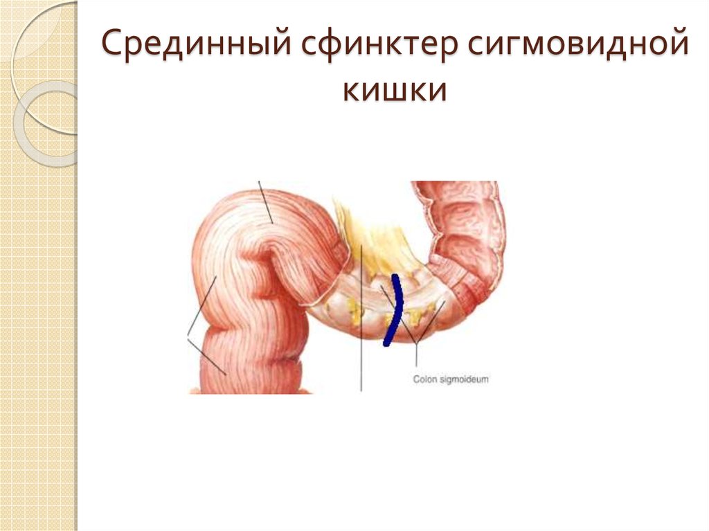 Сфинктеры толстой кишки схема