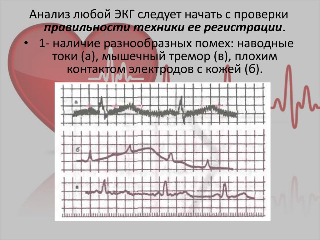 Экг недорого