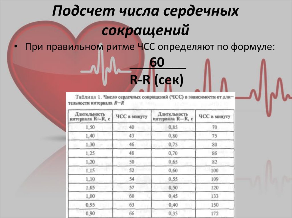 Определение источника возбуждения водителя ритма