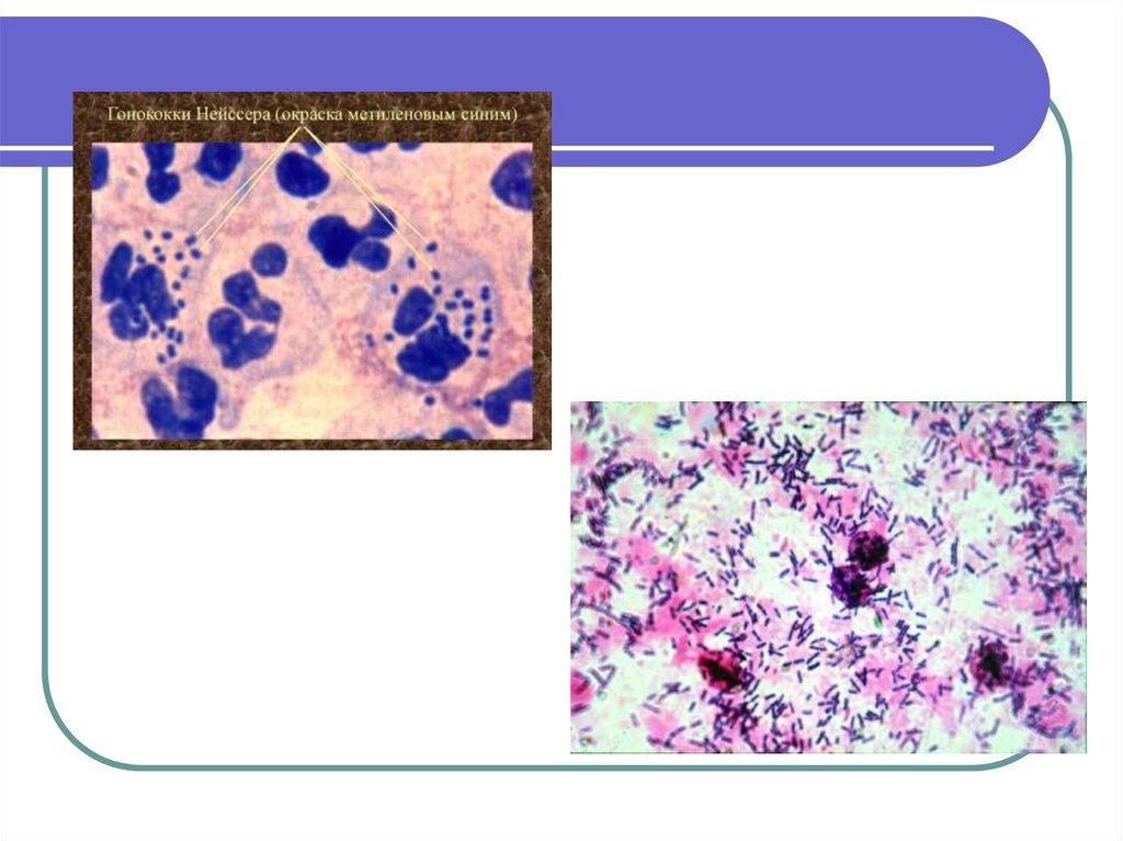 Окраска метиленовым синим. Гонококки окраска метиленовым синим. Гонококки метиленовый синий. Гонококки Нейссера в мазке.