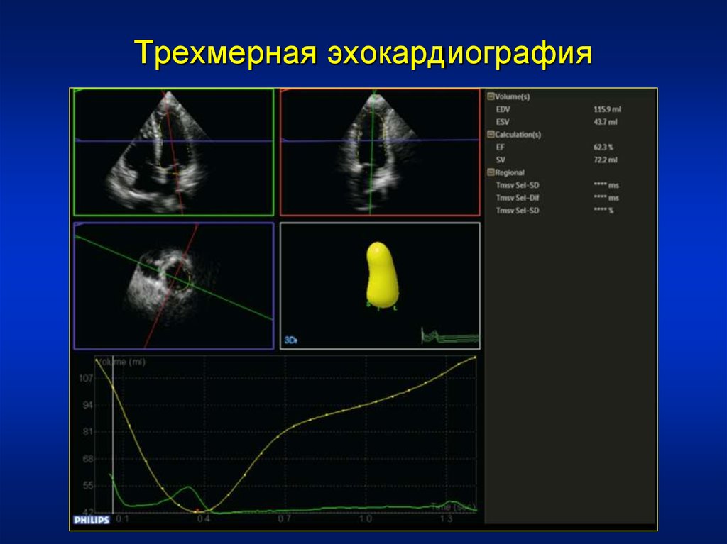 Учебный план эхокардиография