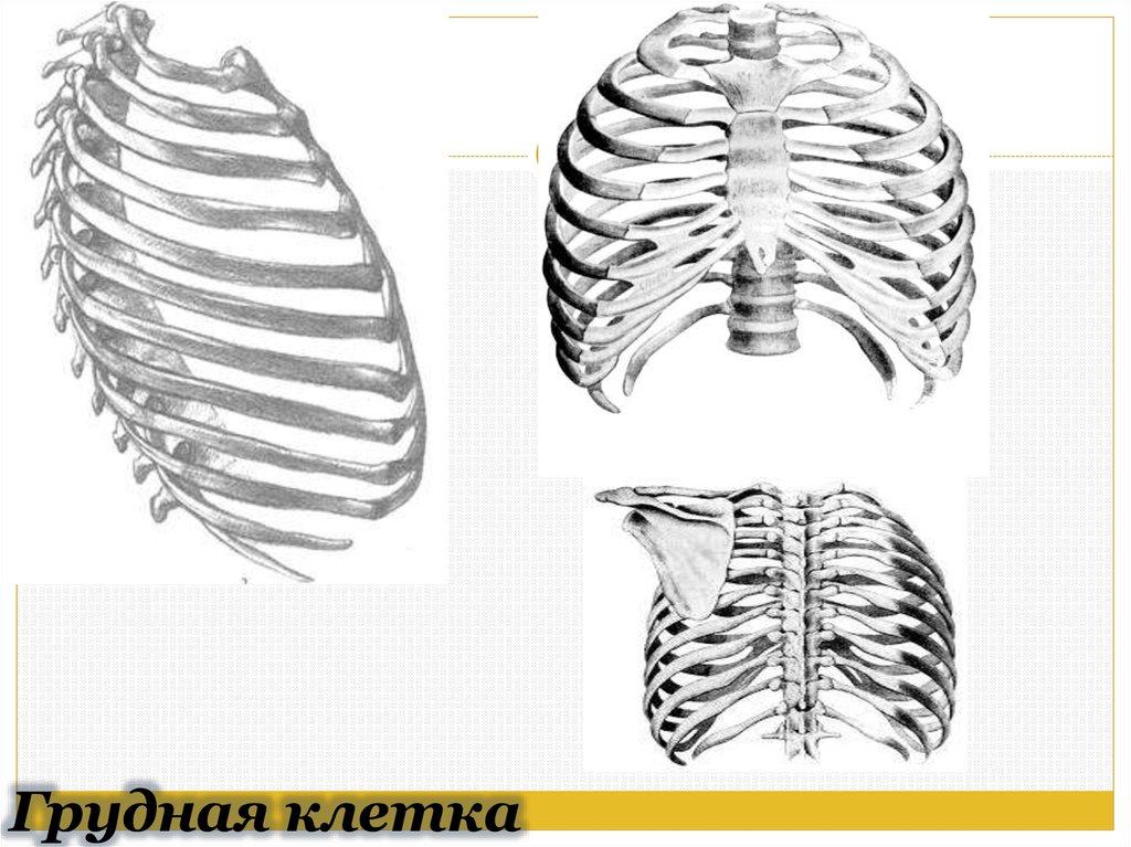 Ладьевидная грудная клетка рисунок