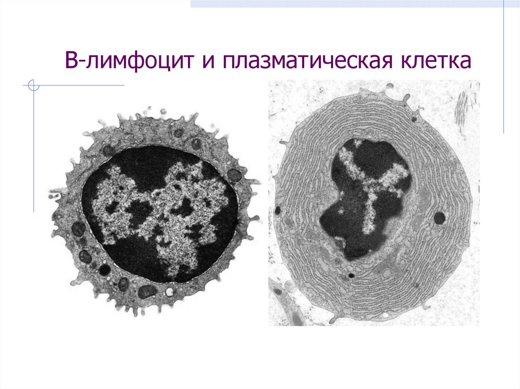 Плазмоциты макрофаги