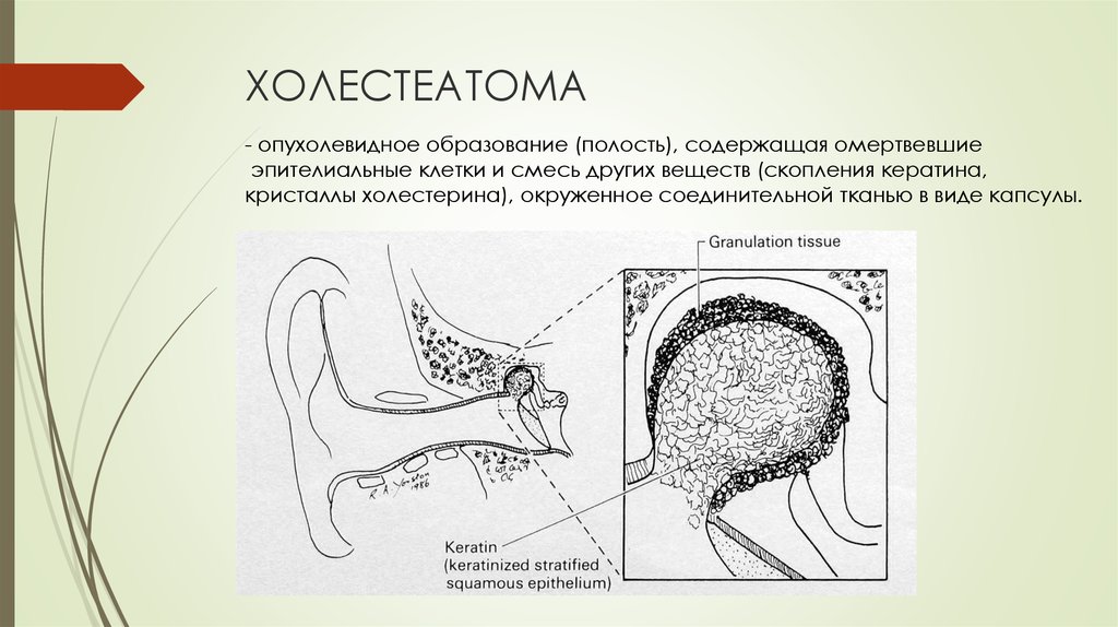 Образование полости