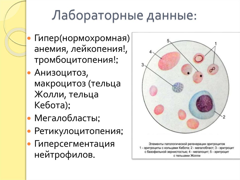 Лейкопения при анемии. Тельца Жолли и Кебота. Анизоцитоз микроцитоз. Микроцитоз макроцитоз анизоцитоз. Лейкоцитопения, тромбоцитопения, анемия.