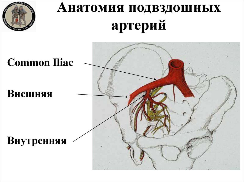 Правая подвздошная артерия. Ветви общей подвздошной артерии схема. Подвздошная артерия анатомия. Подвздошные артерии анатомия схема. Наружная подвздошная артерия.