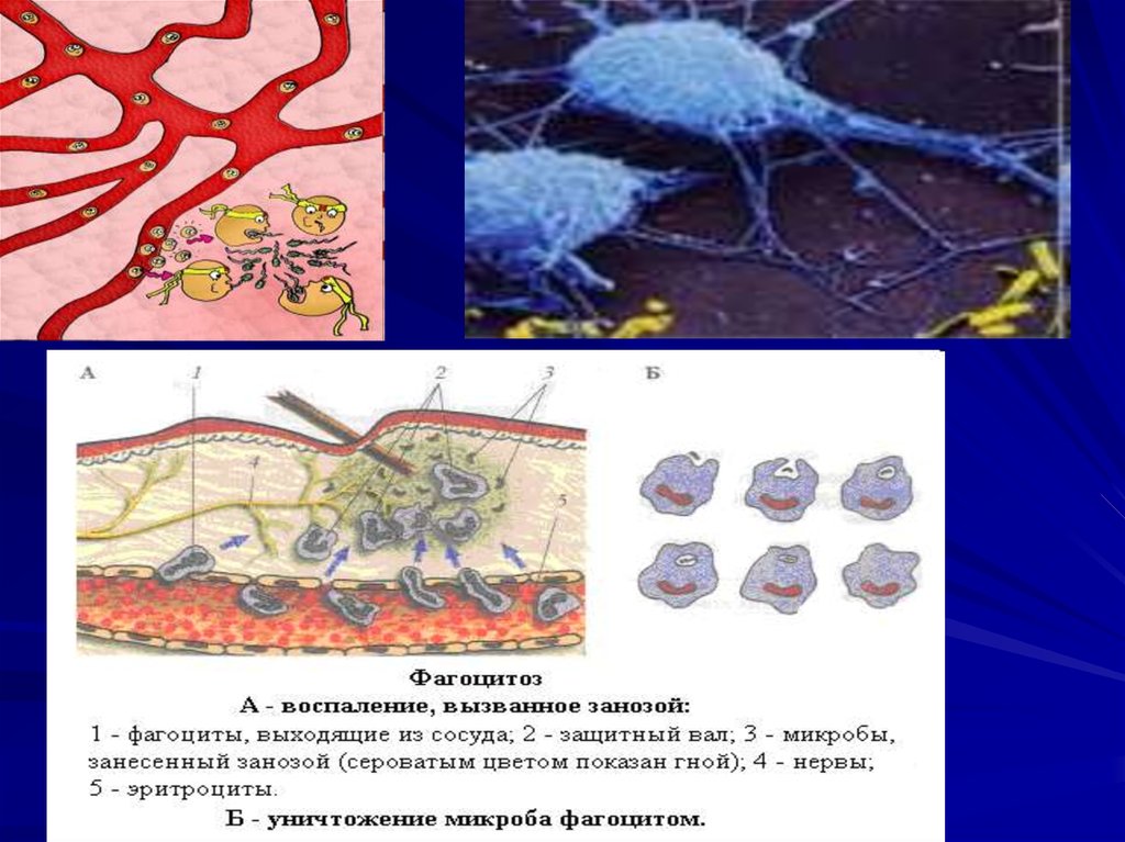 Защита организмов 10 класс. Способностью к фагоцитозу обладают клетки нервной ткани:. Защита организмов биология 10 класс. Защита организмов презентация