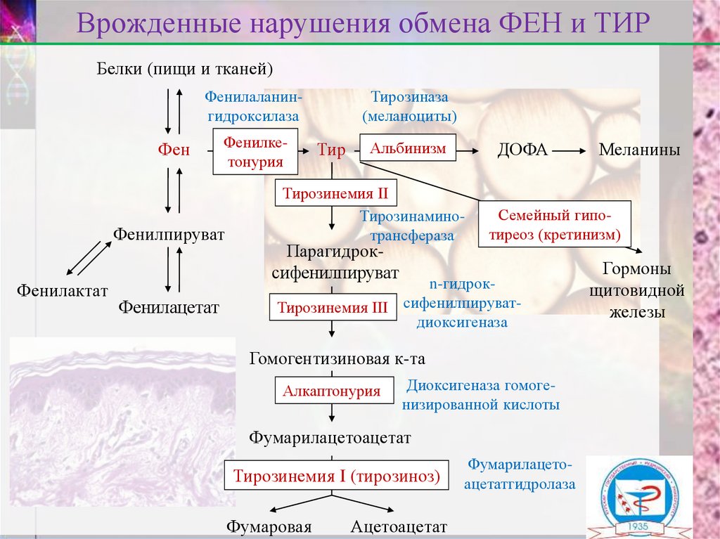 Врожденные нарушения