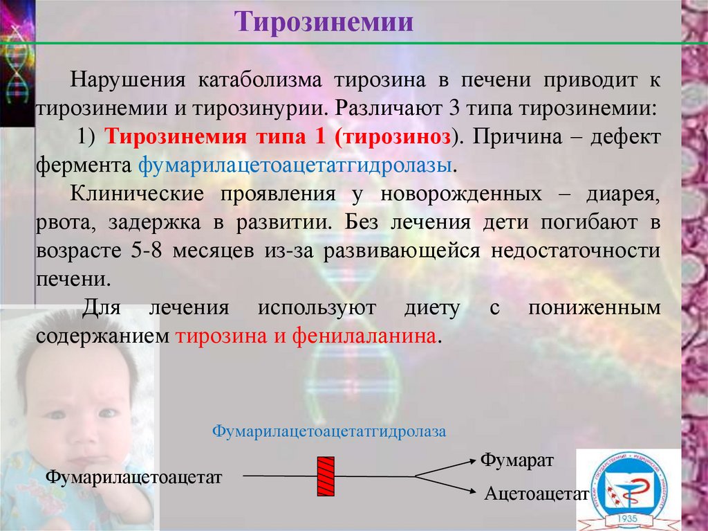 Тирозинемия у детей презентация