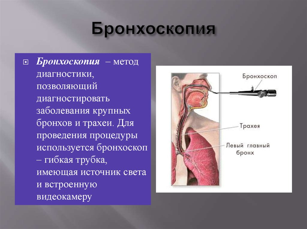 Бронхи фото на человеке месторасположение