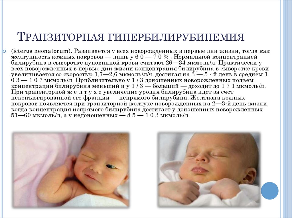 Физиологическая желтуха новорожденных причины. Физиологическая желтушка у новорожденных норма. Физиологическая желтуха новорожденных билирубин. Транзиторные состояния новорожденных желтуха. Новорождённый ребёнок с желтушкой.