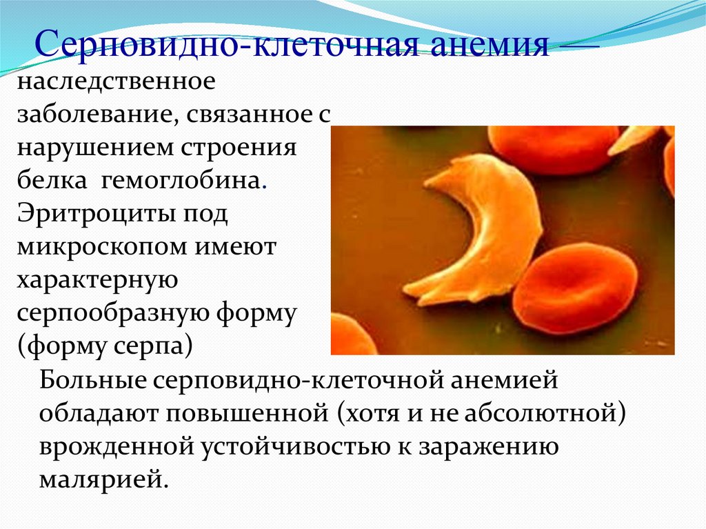 Заболевание анемия. Серповидноклеточная анемия плейотропия. Серповидноклеточная анемия эритроциты форма. Серповидно клетчатая анемия. Серповидноклеточная анемия генная мутация.