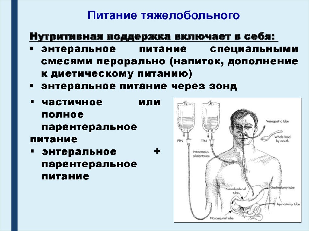 Питание через. Энтеральное и парентеральное питание. Парентеральное питание через зонд. Внутривенное энтеральное питание. Искусственное питание парентеральное.