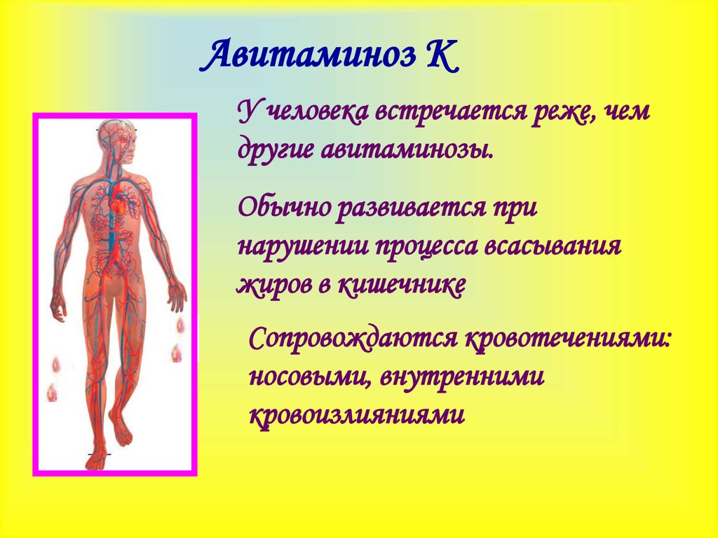 Авитаминоз картинки для презентации