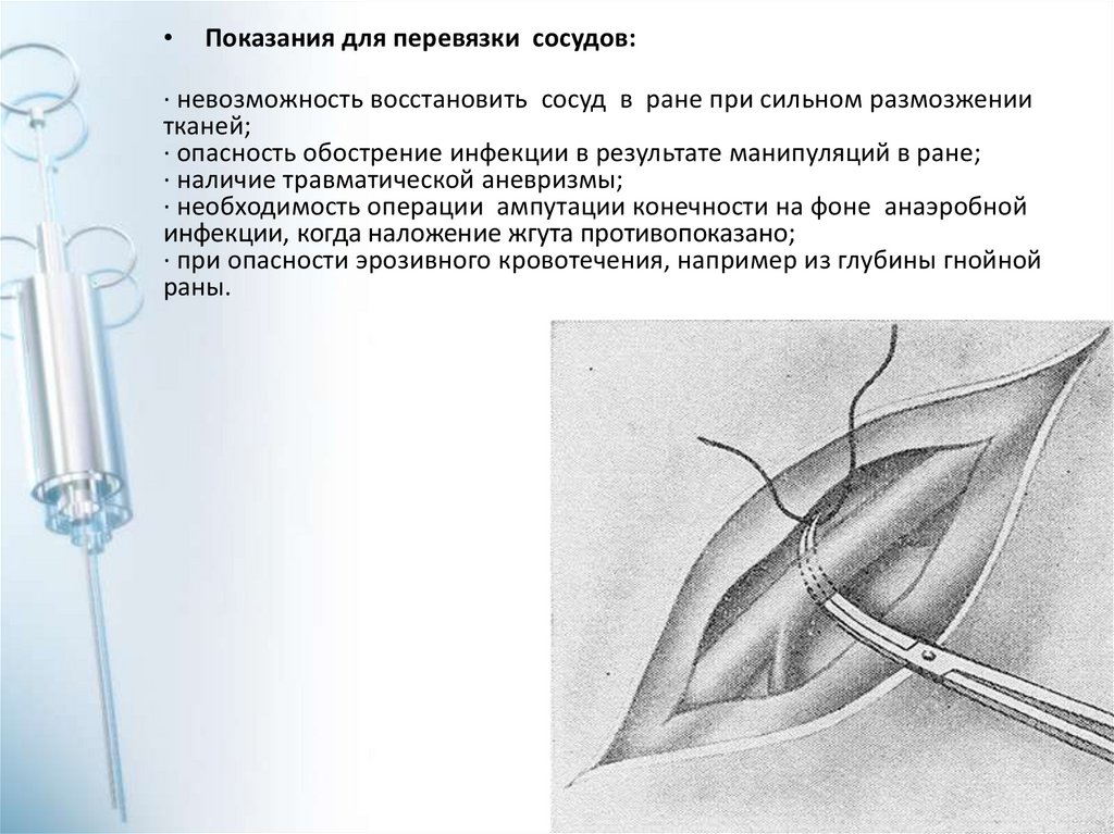 Повреждение кровеносных сосудов