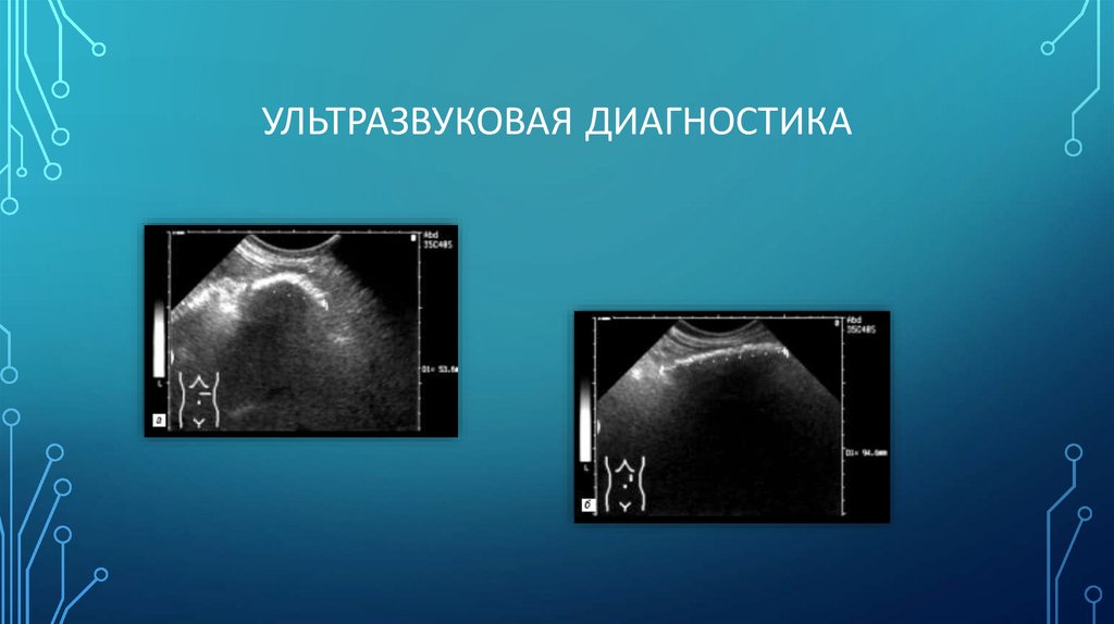 Ультразвуковая диагностика