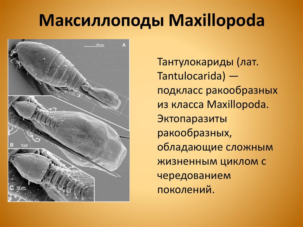 Максиллоподы Maxillopoda