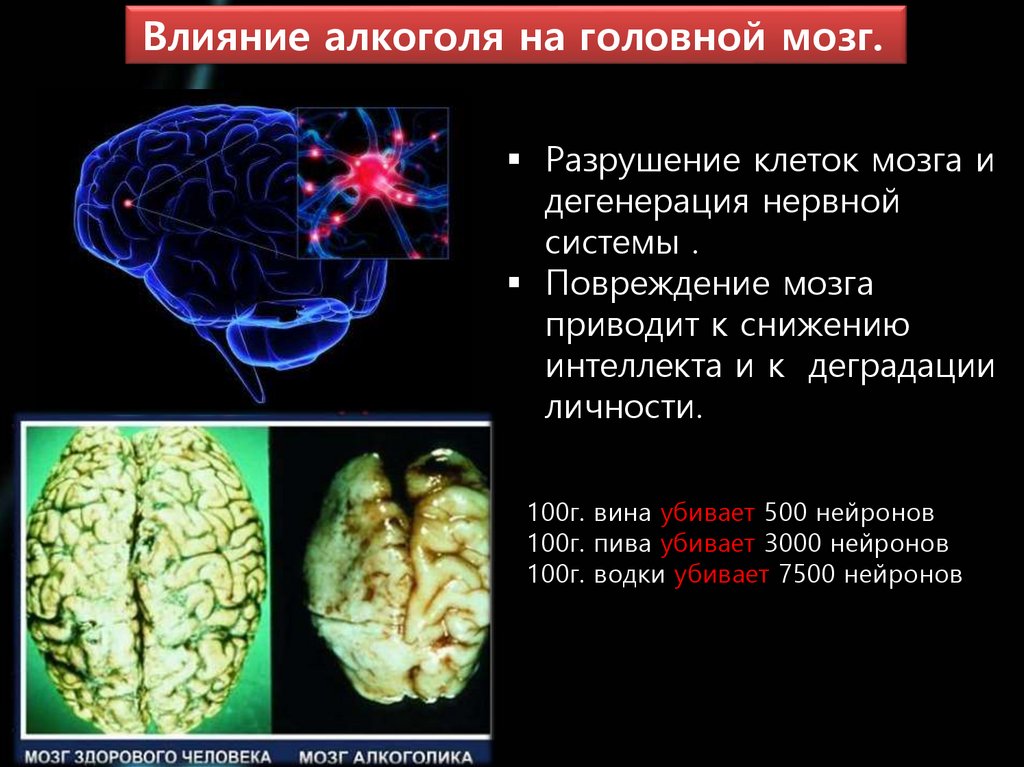 Умершие клетки мозга