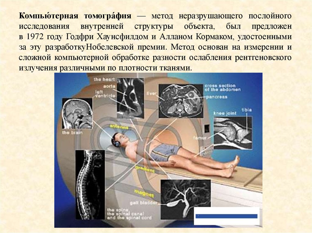 Исследуйте внутренние. Методы компьютерной томографии. Томографический метод исследования. Компьютерная томография мето. Томография метод исследования.