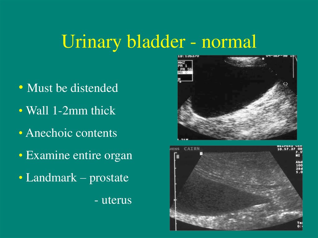 Urinary Tract Ultrasound - презентация онлайн