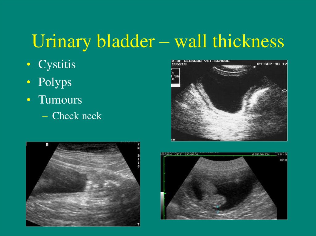 Urinary Tract Ultrasound - презентация онлайн