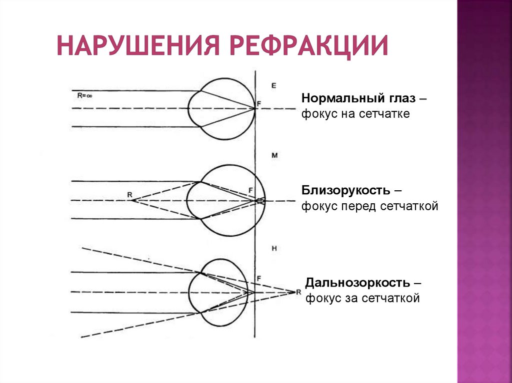 Презентация на тему зрительный анализатор строение и функции глаза