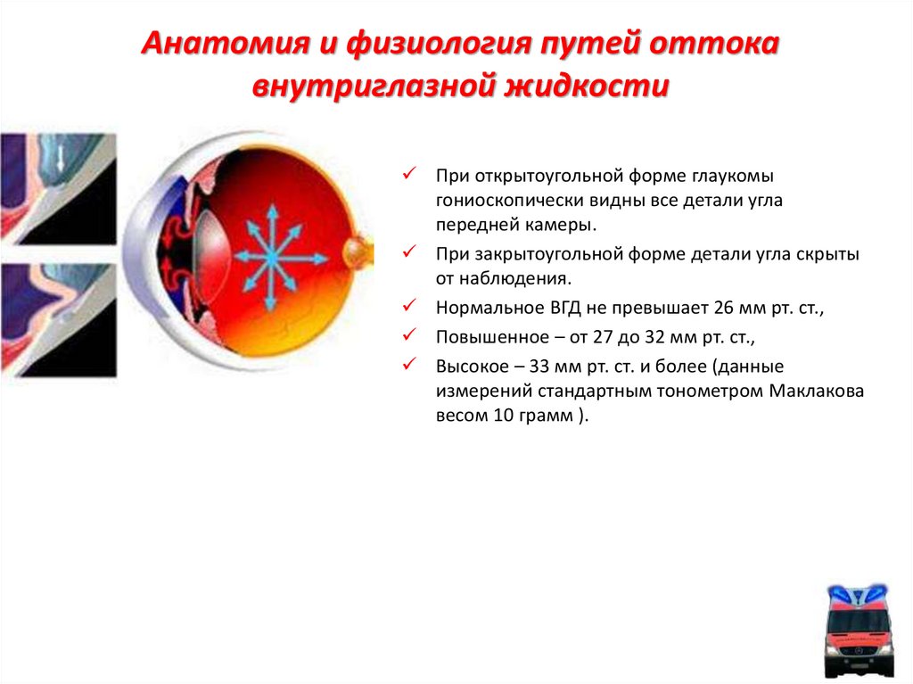 Глаукома презентация офтальмологии