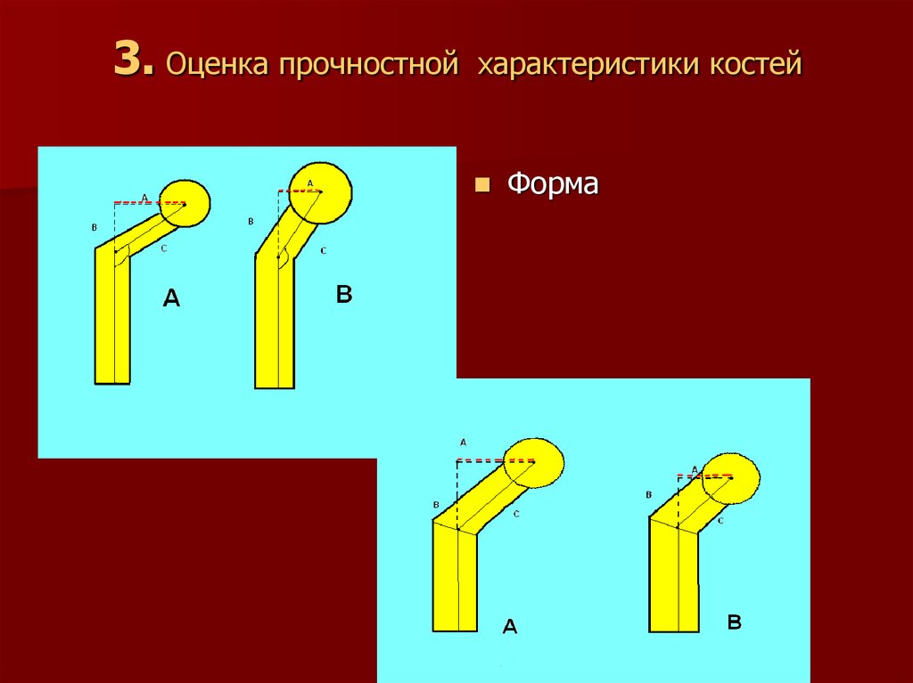 Характер кости