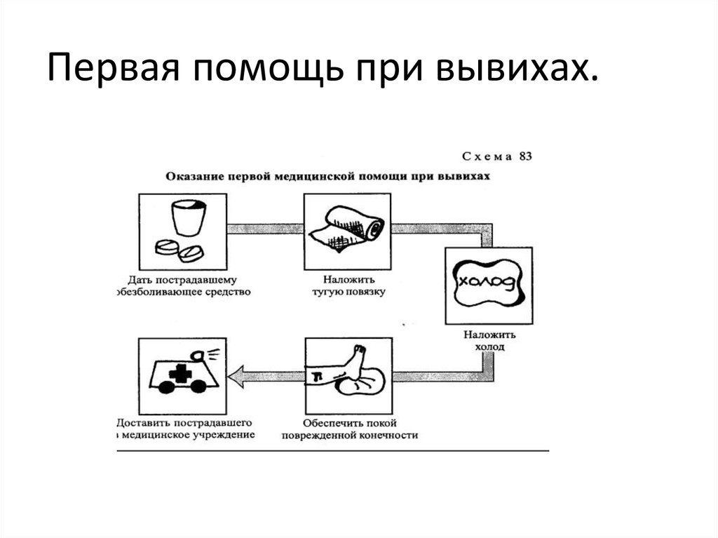 Схема первая. Алгоритм оказания 1 помощи при вывихе. Схема оказания первой помощи при вывихах. Алгоритм оказания первой медицинской помощи при вывихах. Алгоритм оказания первой доврачебной помощи при вывихе.