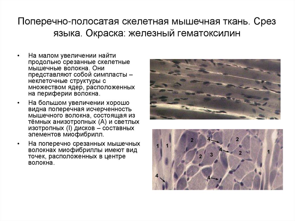 Поперечно полосатая скелетная мышечная ткань. Мышечная ткань Железный гематоксилин. Поперечно полосатая Скелетная мышечная ткань Железный гематоксилин. Скелетная мышечная ткань окраска железным гематоксилином. Поперечная мышечная ткань Железный гематоксилин.