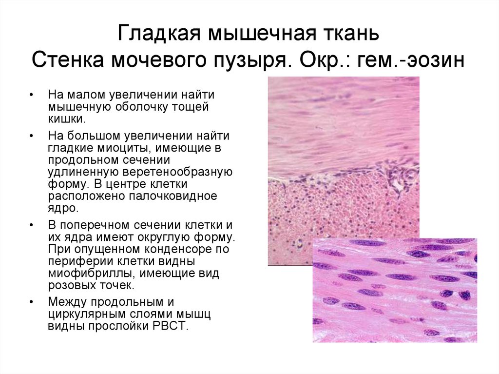 Ткани стенкам. Гладкая мышечная ткань мочевого пузыря гистология. Гладкая мышечная ткань мочевого пузыря окраска гематоксилин эозин. Гладкая мышечная ткань срез стенки мочевого пузыря. Гладкая мышечная ткань мочевого пузыря препарат.