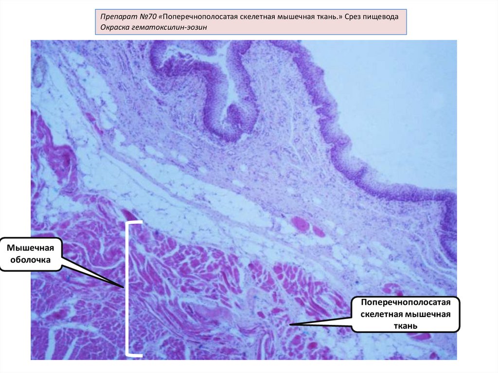 Ткань препарат. Поперечнополосатая Скелетная мышечная ткань препарат. Скелетная мышечная ткань препарат. Поперечно-полосатая мышечная ткань срез пищевода. Поперечнополосатая Скелетная мышечная ткань. Срез пищевода.